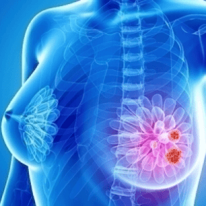 Carcinoma mammario, risultati positivi per elacestrant. Studio di Fase III EMERALD