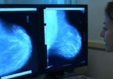 Carcinoma mammario metastatico, ecco le nuove linee guida globali