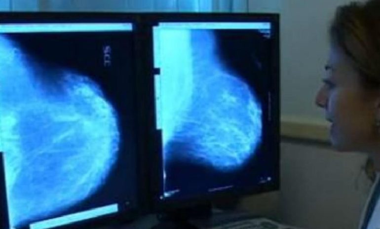 Carcinoma mammario metastatico, ecco le nuove linee guida globali