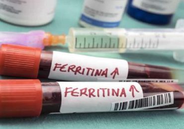 Coronavirus, benefici della terapia con metilprednisolone associati a livelli sierici di ferritina