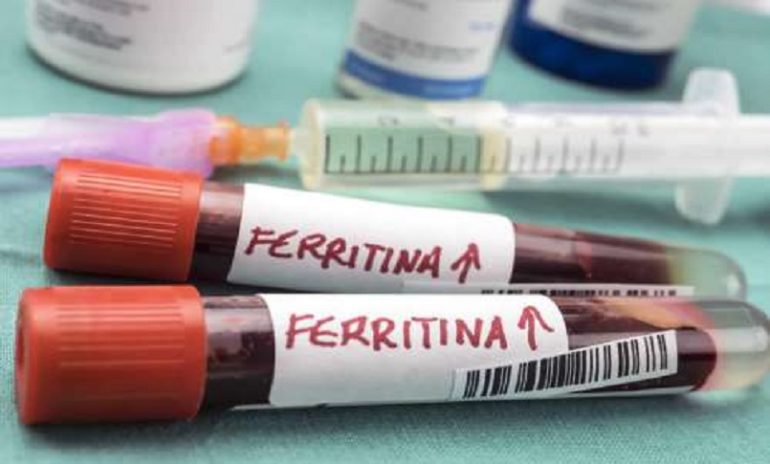 Coronavirus, benefici della terapia con metilprednisolone associati a livelli sierici di ferritina
