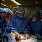 New York, rene di maiale trapiantato per la prima volta su un essere umano