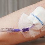 Accessi venosi nel paziente oncologico: nuove indicazioni per somministrare farmaci in sicurezza