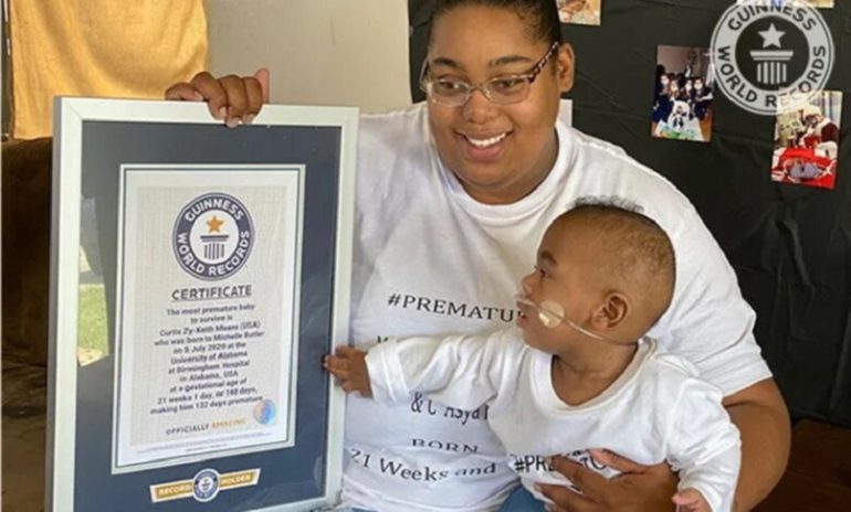 Alabama, bimbo nato prematuro di 132 giorni: è record