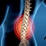 Lesioni spinali, in arrivo nuovo dispositivo biomedico per il recupero motorio