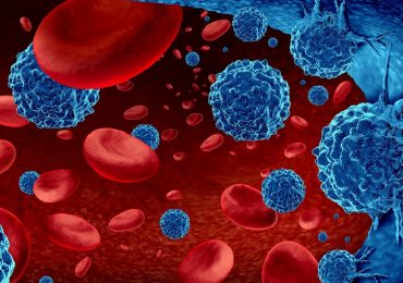 Mieloma multiplo: nuove speranze dal trapianto autologo di cellule staminali