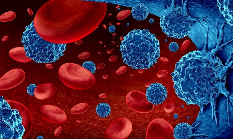 Mieloma multiplo: nuove speranze dal trapianto autologo di cellule staminali