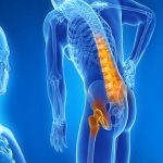 Osteoartrosi: nuove terapie infiltrative per una reale rigenerazione della cartilagine