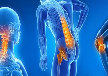 Osteoartrosi: nuove terapie infiltrative per una reale rigenerazione della cartilagine