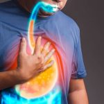Reflusso gastroesofageo: sintomi, alimentazione e farmaci