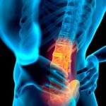Spondilolistesi: sintomi e cura