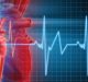 Tachicardie ventricolari: radioablazione efficace nel trattamento delle aritmie più gravi