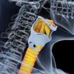 Trapianto di trachea: nuova frontiera della chirurgia toracica. Gli esperti: "Una rivoluzione anche per l'emergenza Covid"