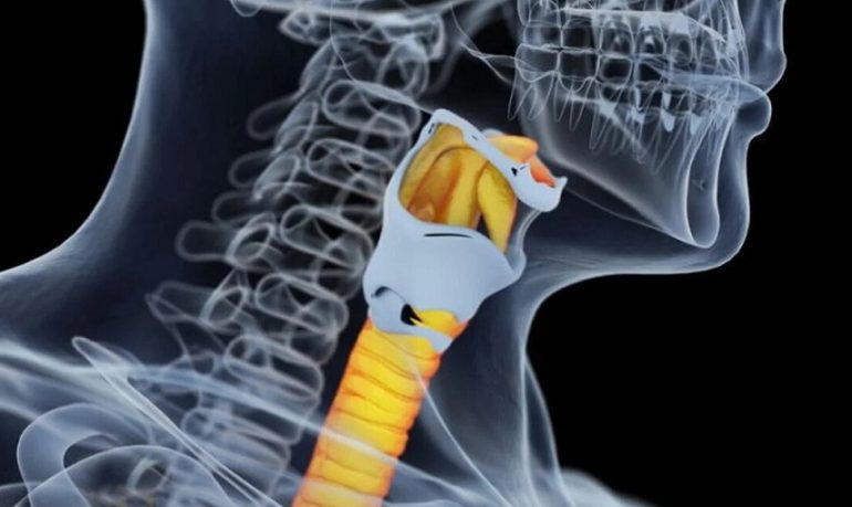 Trapianto di trachea: nuova frontiera della chirurgia toracica. Gli esperti: "Una rivoluzione anche per l'emergenza Covid"