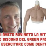 Parla il medico che ha indossato il braccio in silicone:”Ho bisogno del Green Pass ma non credo nei vaccini: mi avete rovinato la vita”