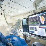 Ablazione cardiaca: durata, convalescenza e rischi