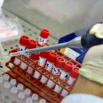Aids, il vaccino resta una sfida aperta