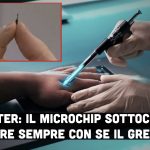 Epicenter: grazie all’impianto di un microchip sottocutaneo sarà possibile avere sempre con se il Green Pass