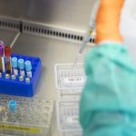 Hiv: risultati promettenti da vaccino sperimentale a mRna testato sui macachi