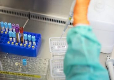 Hiv: risultati promettenti da vaccino sperimentale a mRna testato sui macachi