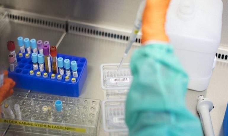 Hiv: risultati promettenti da vaccino sperimentale a mRna testato sui macachi