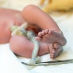 Nati prematuri, ritardare di un minuto il taglio del cordone ombelicale riduce rischi di disabilità e morte