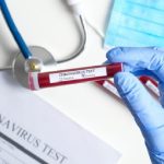 Variante Omicron, "Attuali test sierologici non sono attendibili"