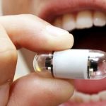 Videocapsula endoscopica: indicazioni, preparazione e controindicazioni