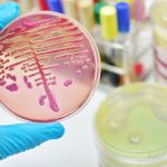 Batteri multiresistenti: una nuova pandemia. Il ruolo dell'infermiere epidemiologo