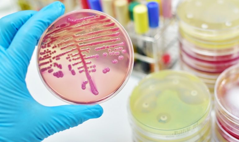 Batteri multiresistenti: una nuova pandemia. Il ruolo dell'infermiere epidemiologo