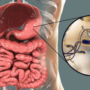 Helicobacter pylori: tutto quello che c'è da sapere