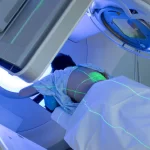 La radioterapia: quando si utilizza, obiettivi effetti indesiderati