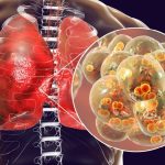 Malattie invasive, Aifa approva nuovo vaccino anti-pneumococcico