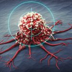 Oncologia: la rivoluzione delle nuove terapie