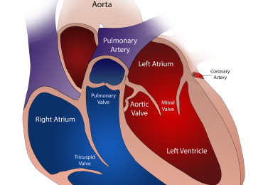 Prolasso della valvola Mitrale: sintomi, cause, diagnosi e terapia