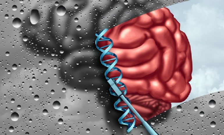 Alzheimer, individuate le 75 componenti genetiche coinvolte: svolta per nuove terapie?