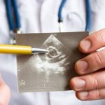 Stenosi aortica, impianto valvolare transcatetere ha effetti più duraturi della sostituzione chirurgica a 5 anni