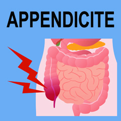Appendicite: sintomi, cause, diagnosi, terapia, prevenzione e complicazioni 1