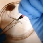 Suture, creata una "biocolla" rapida e super resistente