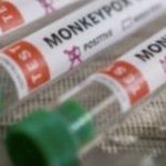 Vaiolo delle scimmie, circolare del ministro: "Vaccinazione da considerare per il personale sanitario"