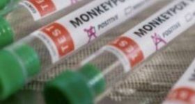 Vaiolo delle scimmie, circolare del ministro: "Vaccinazione da considerare per il personale sanitario"
