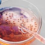 Vaiolo delle scimmie, ok della Fda a farmaco in formulazione endovenosa. Gli esperti: "Pazienti contagiosi fino a 4 settimane dopo i sintomi"