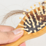 Alopecia areata, oggi si può curare: l'esperienza di Martina 1