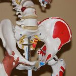 Coxartrosi: cos'è, sintomi, diagnosi, terapia e trattamento