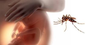 Virus Zika, ecco come può danneggiare lo sviluppo cerebrale dei nascituri
