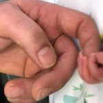 Brasile, non assiste alla nascita del figlio: aggredisce ginecologo e tre infermiere