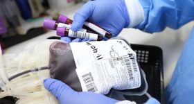 La dott.ssa Beccaccioli presenta una ricerca infermieristica sulla donazione di sangue e le reazioni avverse