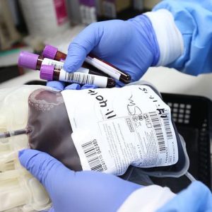La dott.ssa Beccaccioli presenta una ricerca infermieristica sulla donazione di sangue e le reazioni avverse