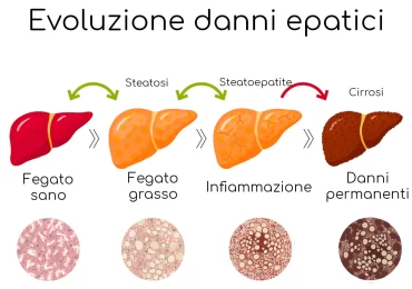 Esami del sangue per valutare lo stato di salute del fegato: quali sono e come interpretarli 1