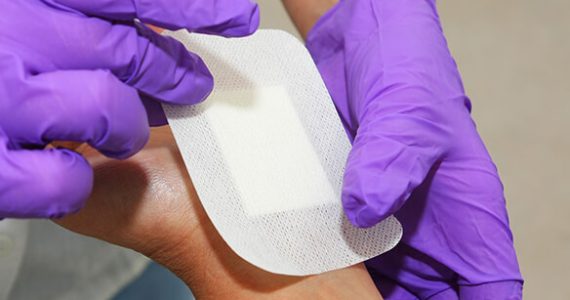 L’infermiere specialista in Wound Care: conosciamo tutti i tipi di medicazioni avanzate